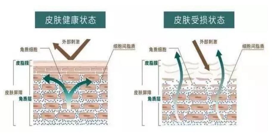 友肌1:1:1修复皮肤屏障，问题皮秒变鸡蛋肌 